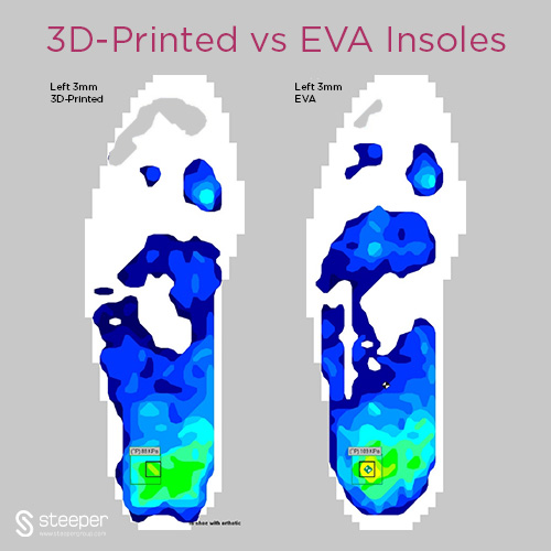 3D-Printed Insole Usage Expands to Diabetic Insensate Patients After Successful Pilot Study